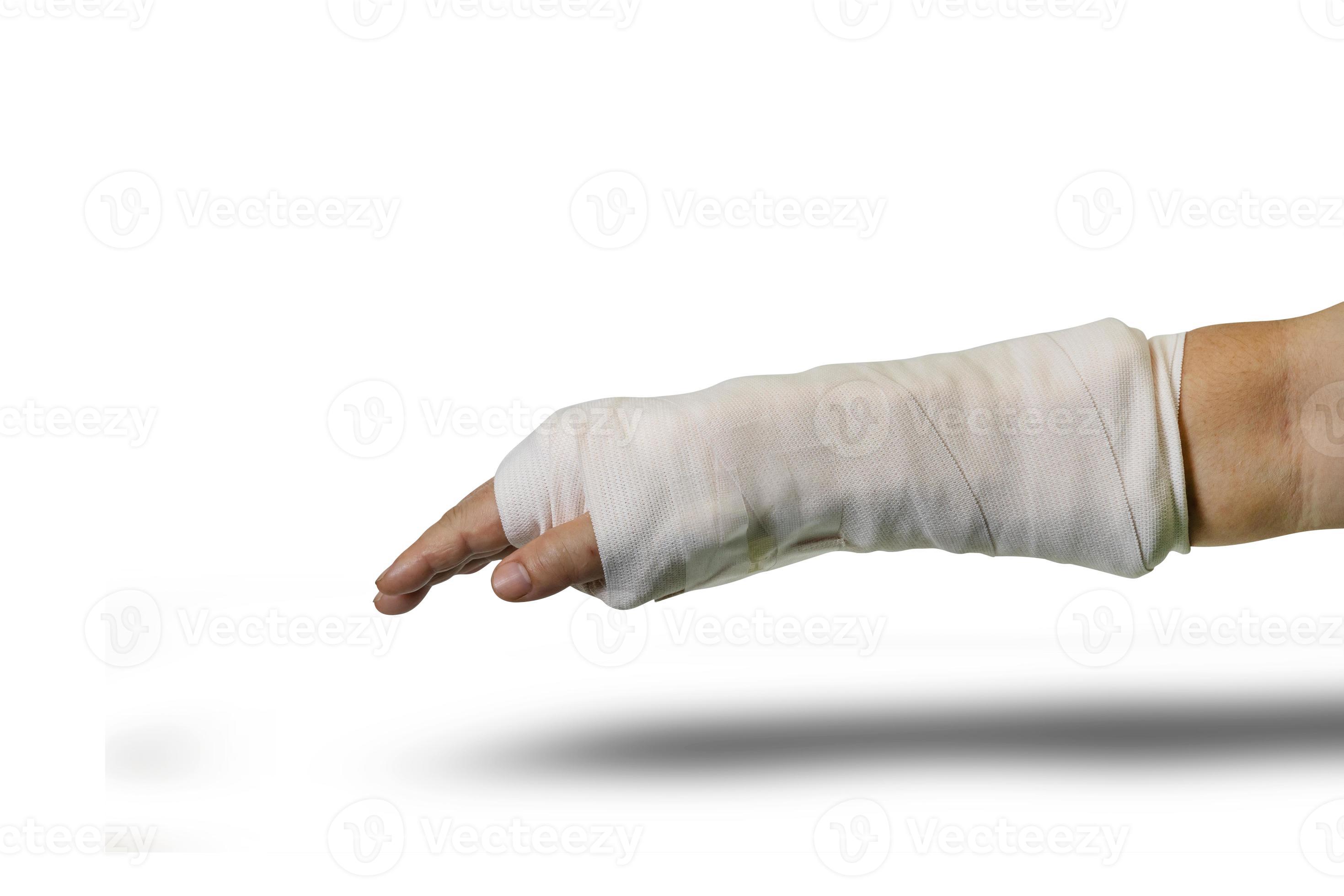 broken arm splinting from accident isolated on white background