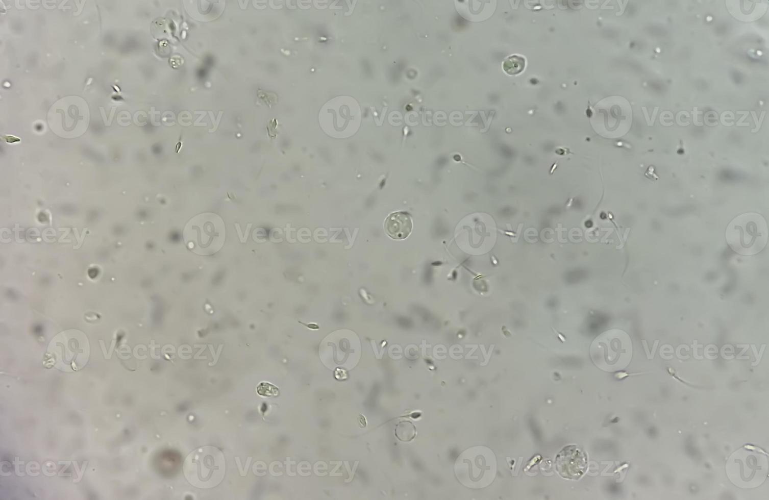 análisis de semen bajo microscopía que muestra piospermia o leucocitospermia. análisis de esperma foto