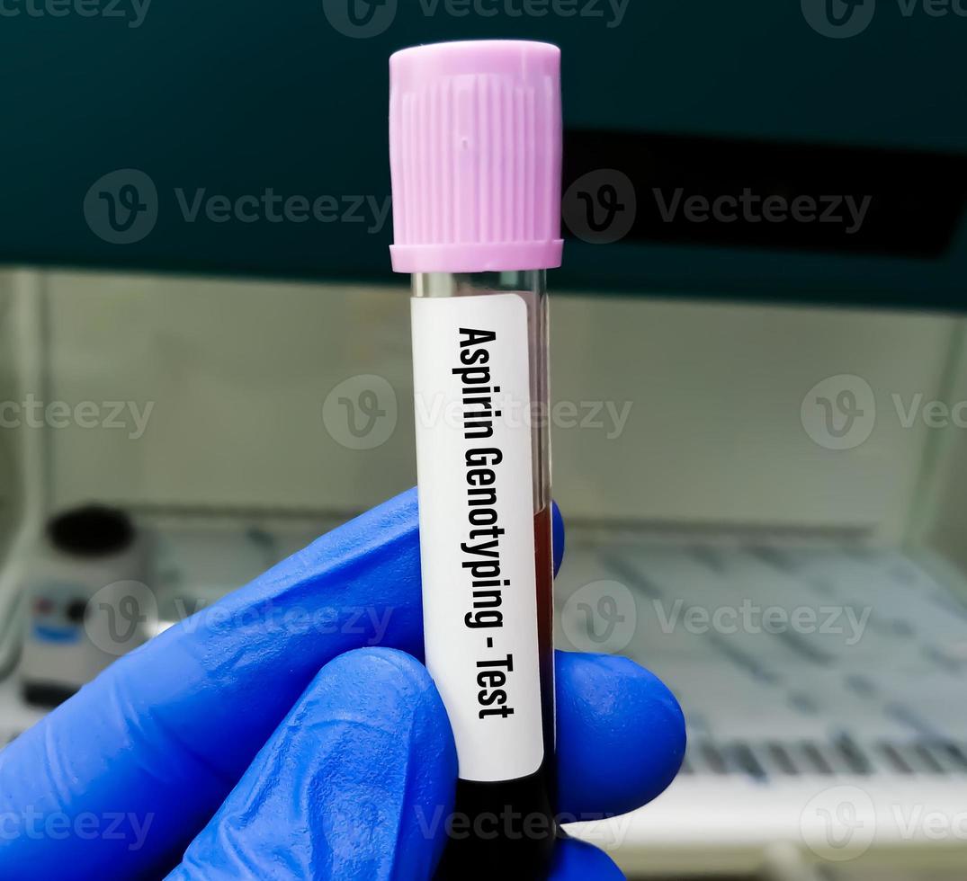 Biochemist or scientist hold blood sample for Aspirin Genotyping test in PCR laboratory. Diagnosis salicylate intoxication due to an overdose of aspirin. photo