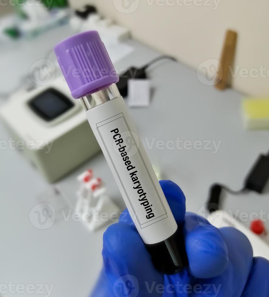 Blood sample for PCR based karyotyping testing. disorder