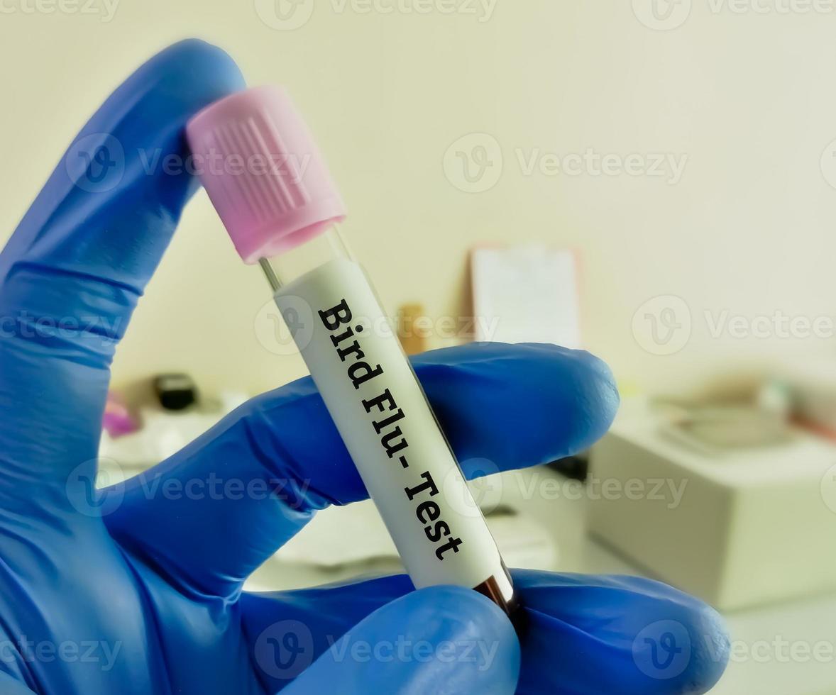 muestra de sangre para la prueba de gripe aviar. foto