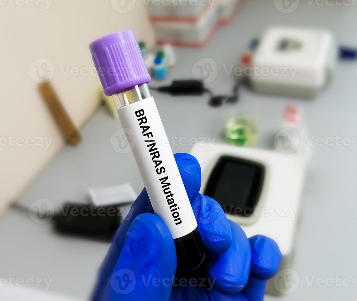 Blood sample for BRAF-NRAS Mutation testing is done to look for genetic changes in tumors that are present in some cancers, including metastatic melanoma, lung cancer, colon cancer and others. photo