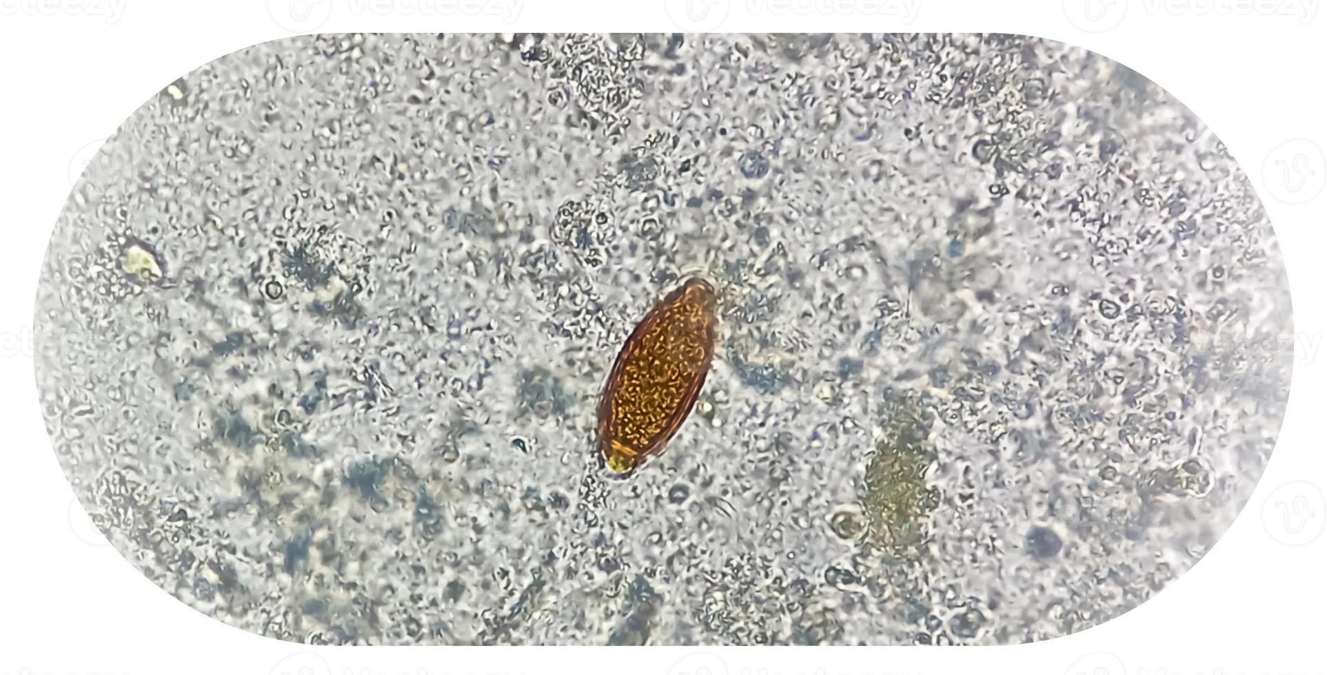 Eggs of Trichuris trichiura whipworm in stool, analyze by microscope photo