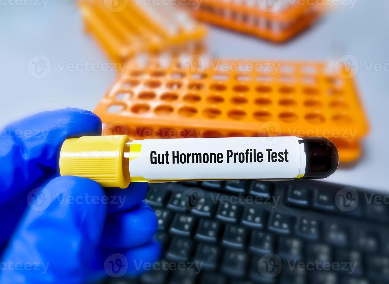 Blood sample for Gut Hormone profile test. photo
