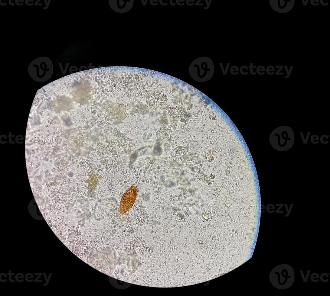 Eggs of Trichuris trichiura whipworm in stool, analyze by microscope photo