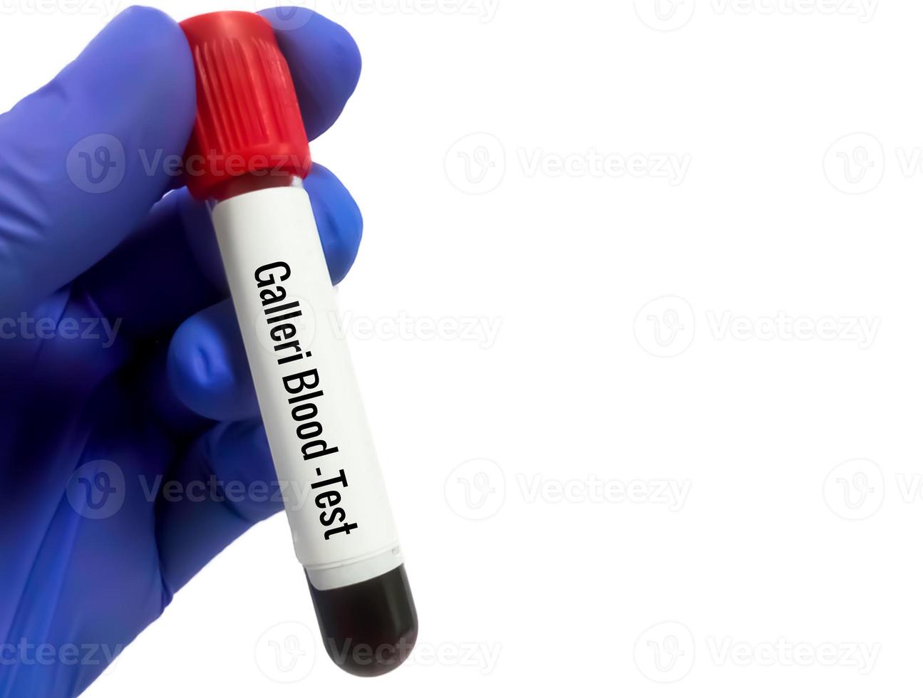 Researcher holding blood sample tube for Galleri blood test for the early diagnosis of multi cancer, more than 50 types of cancer photo