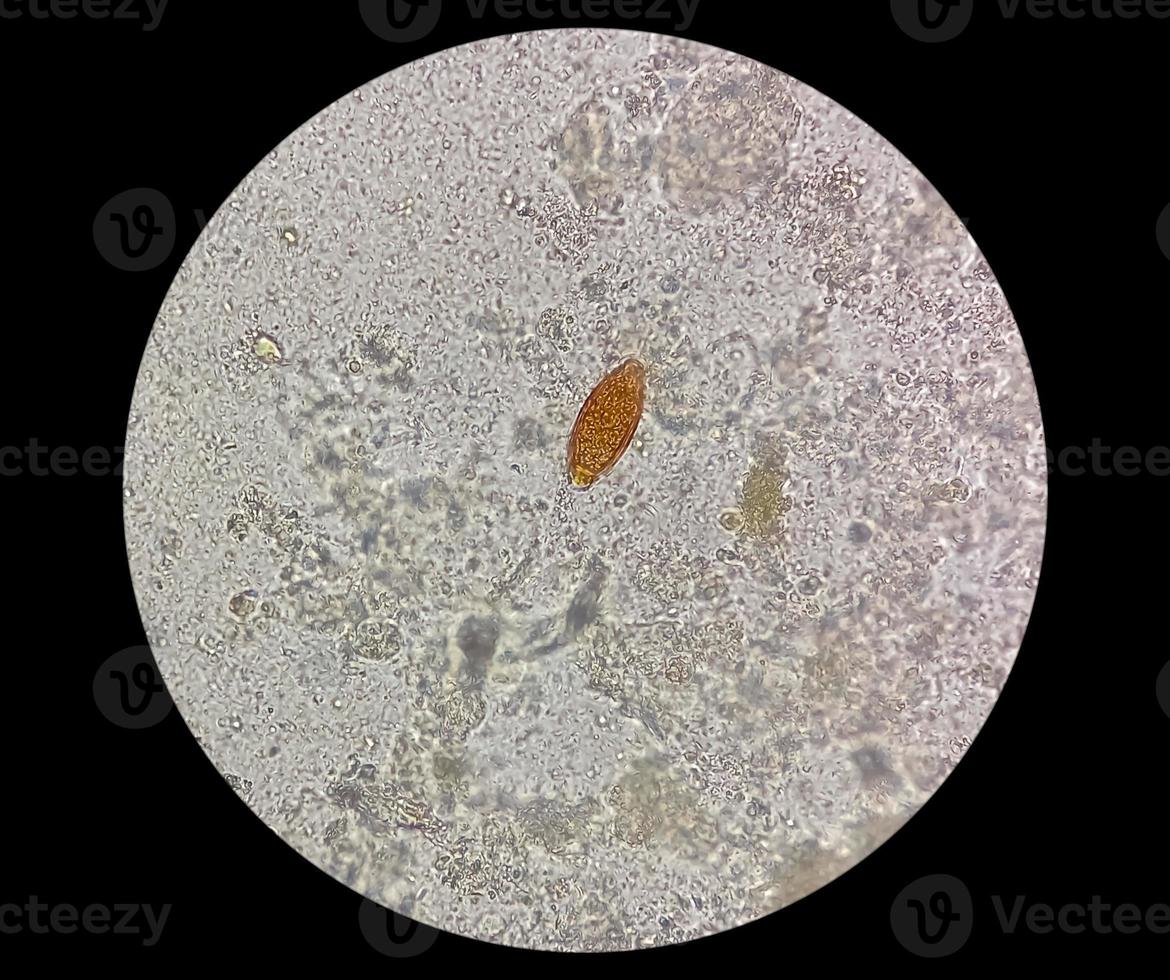 Eggs of Trichuris trichiura whipworm in stool, analyze by microscope photo