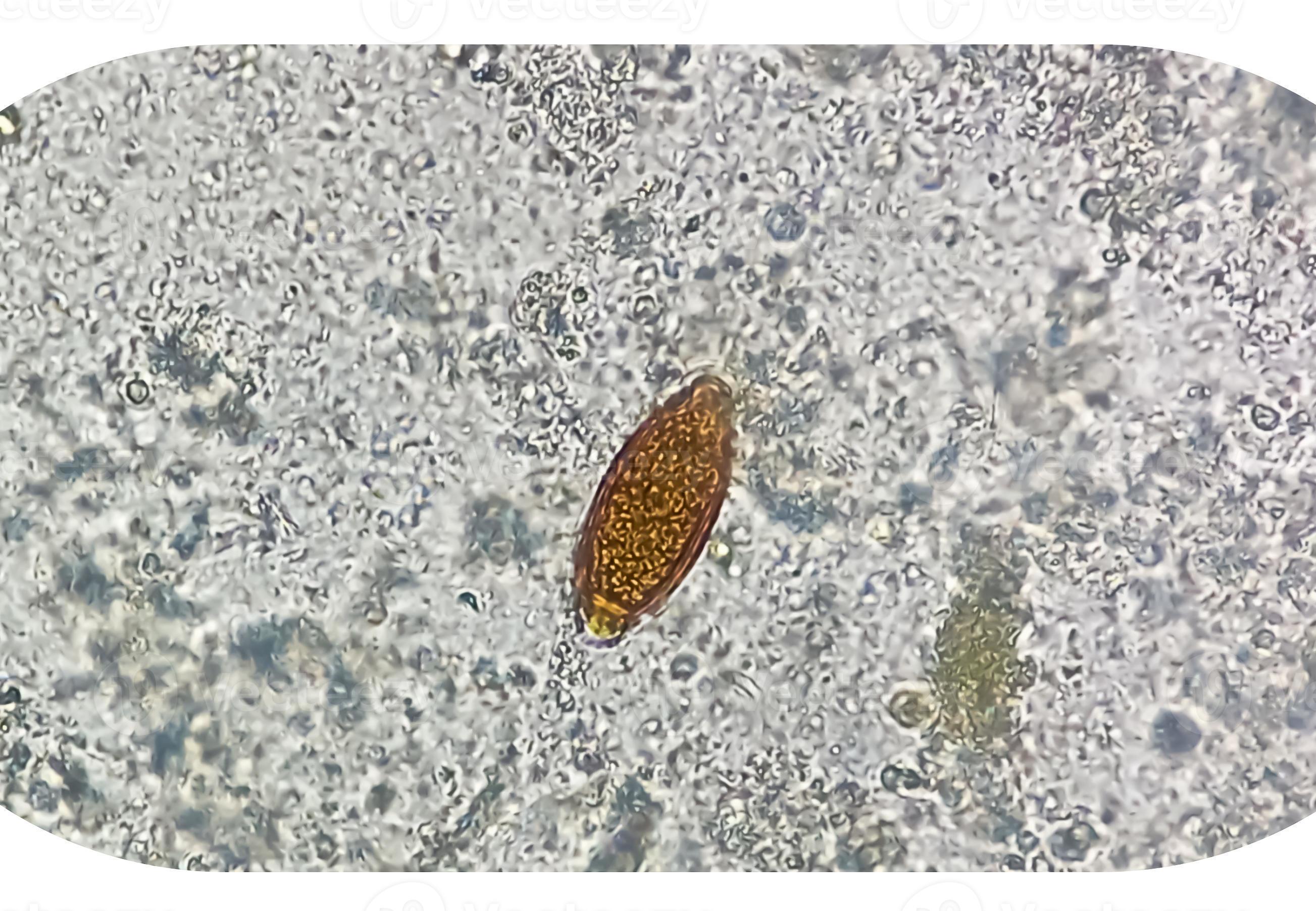 Eggs of Trichuris trichiura whipworm in stool, analyze by microscope