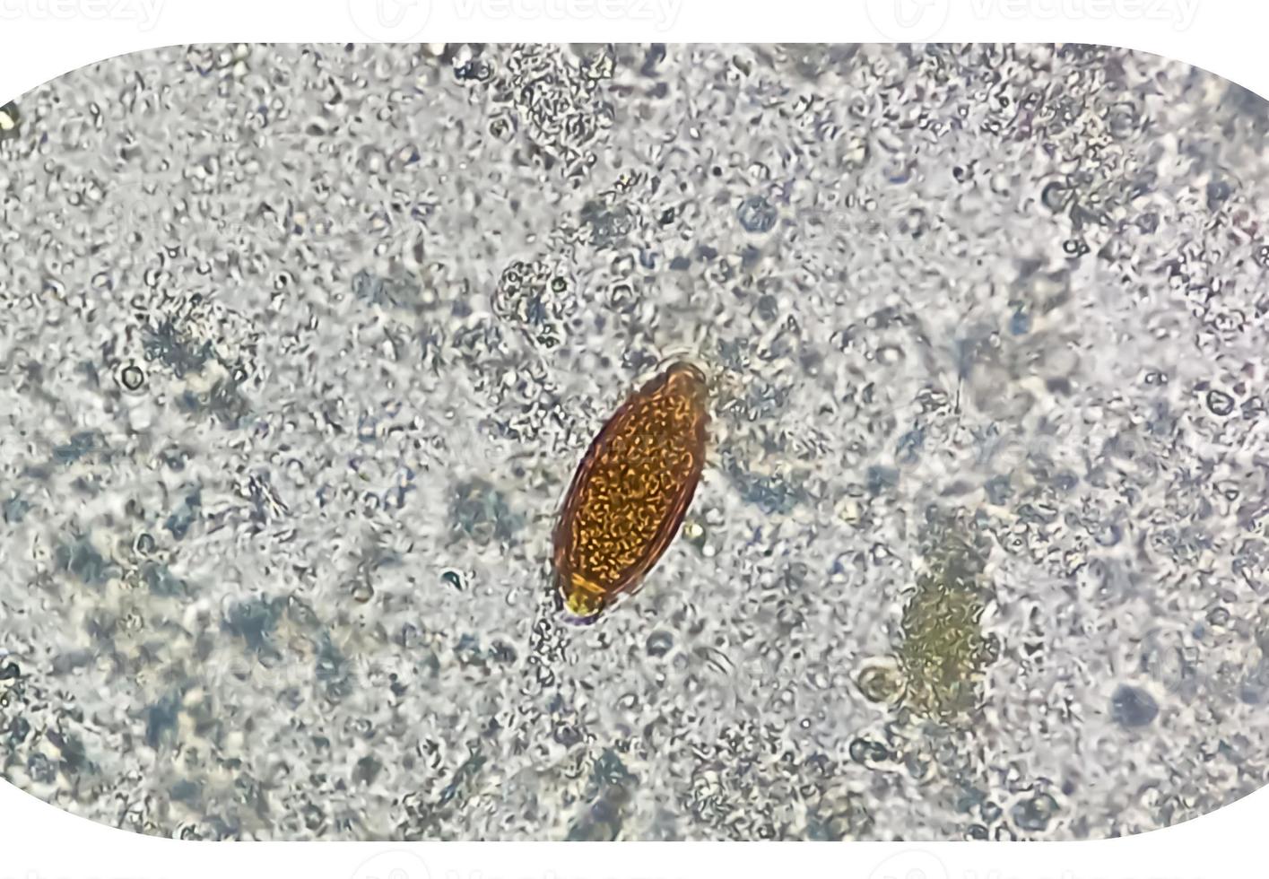 Eggs of Trichuris trichiura whipworm in stool, analyze by microscope photo