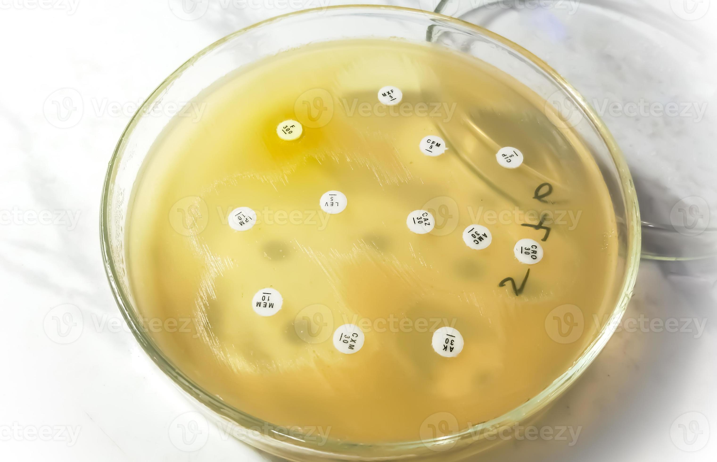 Antimicrobial susceptibility testing in petri dish. Antibiotic