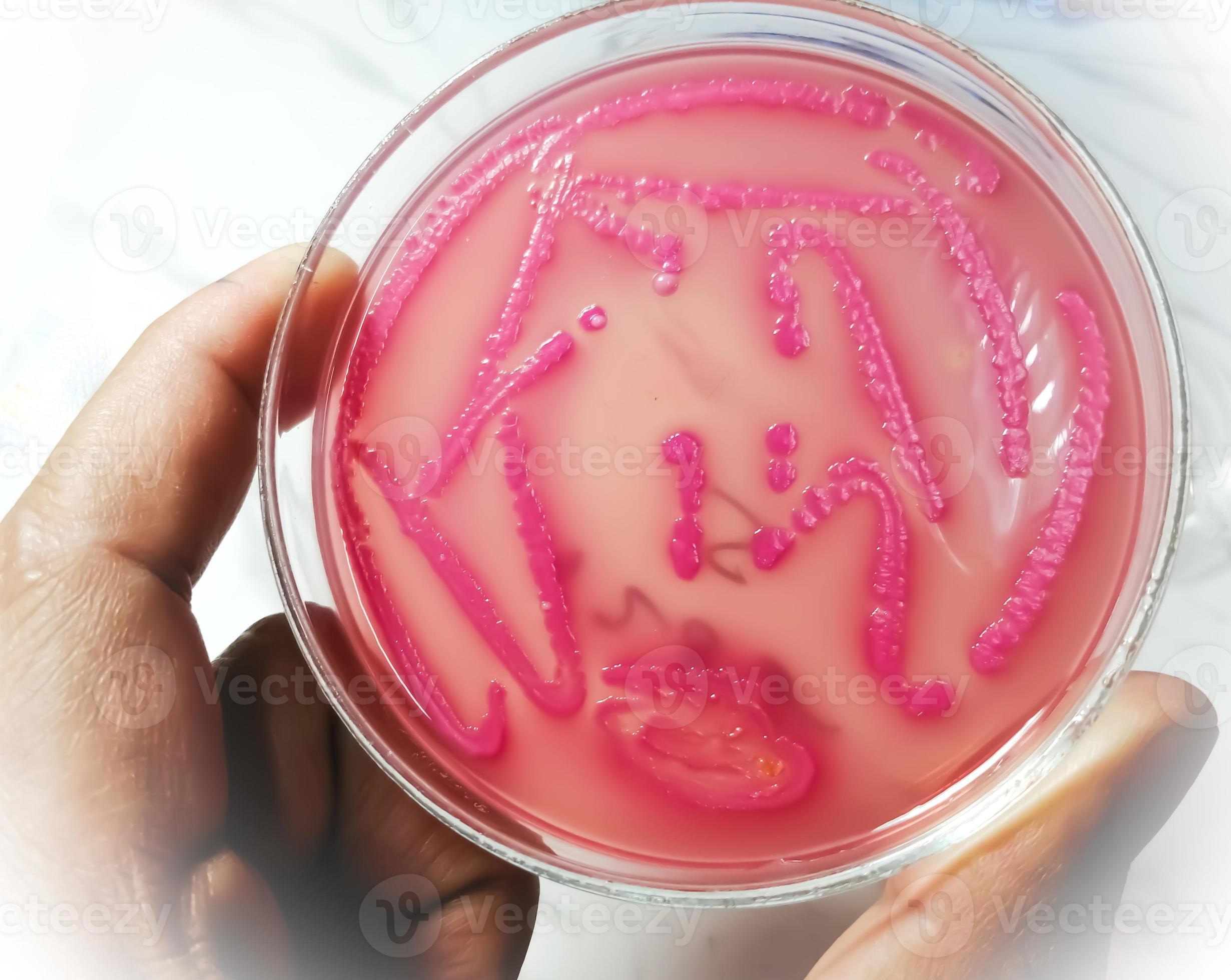 Bacteria colony on culture media plate, stool culture 13675291 Stock