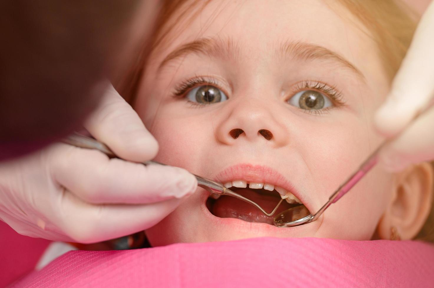 el dentista examina los dientes de leche de la niña, el tratamiento de los dientes de leche, el dentista sostiene un espejo. foto