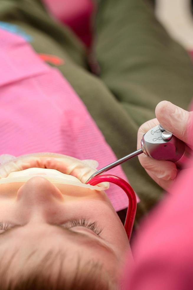 Dental treatment of a child, removal of caries with a drill, open mouth and ejector saliva. photo