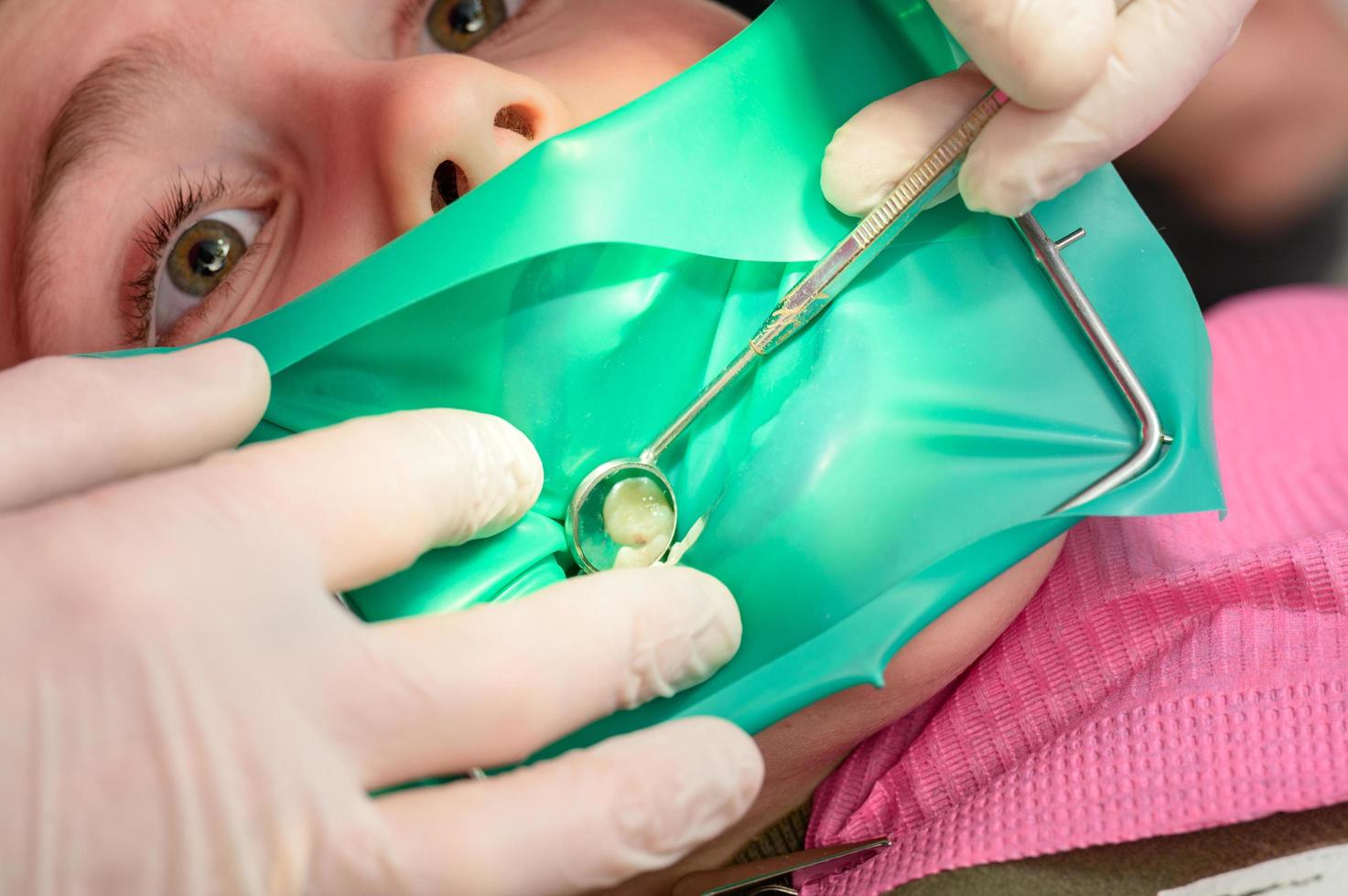 The dentist treats the child's tooth using a rubber dam. photo