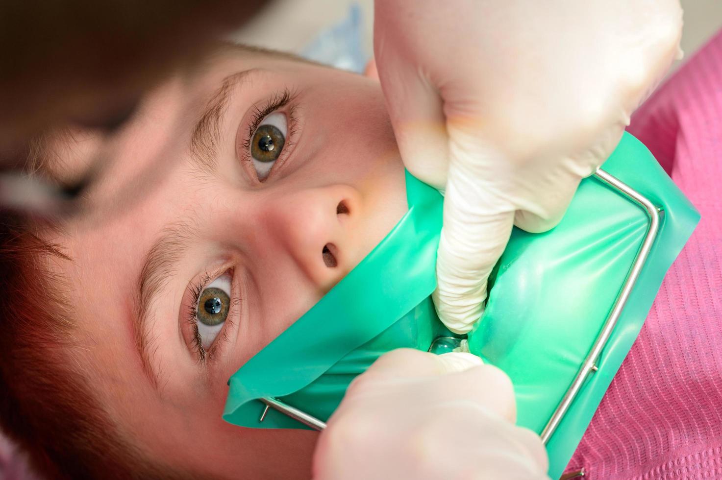 The dentist treats the child's tooth using a rubber dam. photo