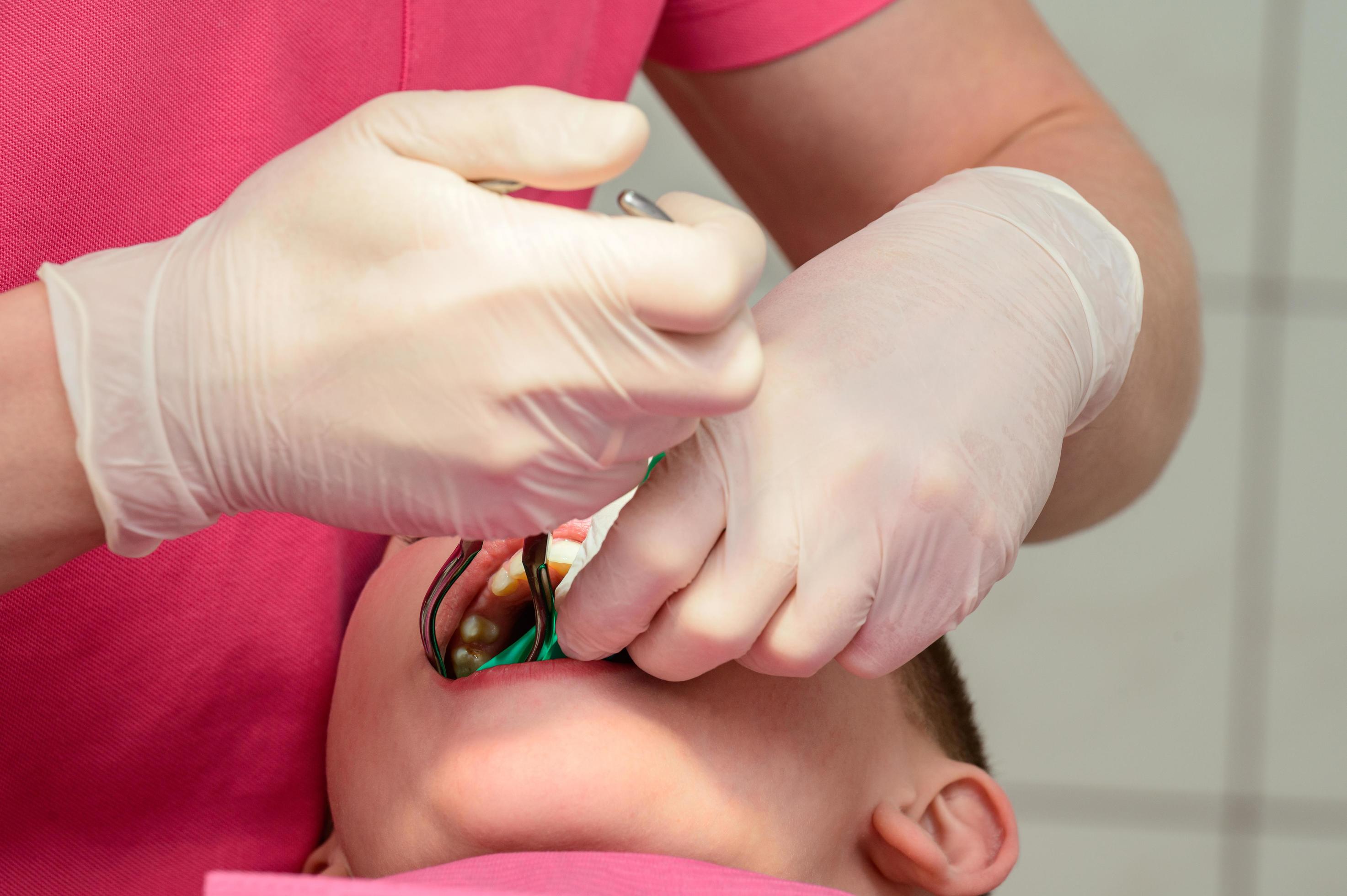 The dentist installs a rubber dam and a clamp for the treatment of a
