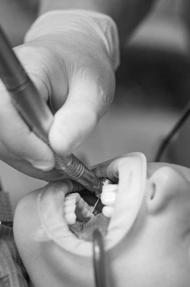 Dentist cleans tooth decay in a child with a drill, in the child's mouth ejector saliva. photo