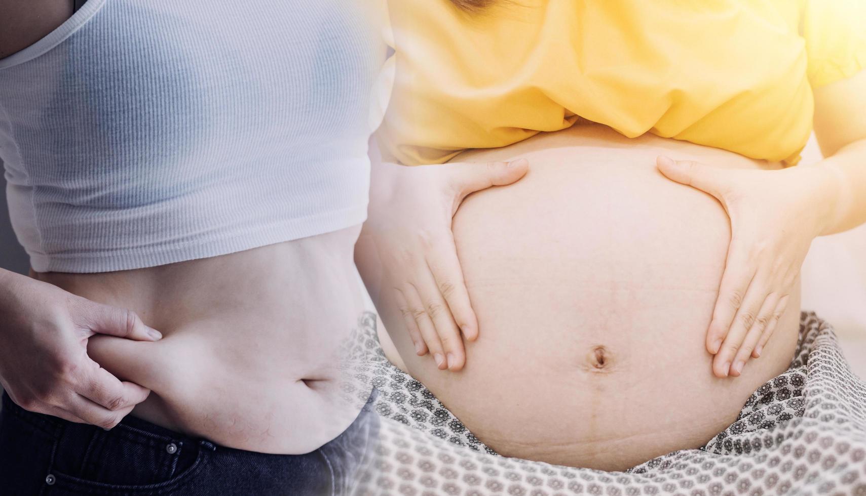 hermosa mujer gorda con cinta métrica usa su mano para exprimir el exceso de grasa que está aislado en un fondo blanco. ella quiere perder peso, el concepto de cirugía y descomponer grasa bajo el foto