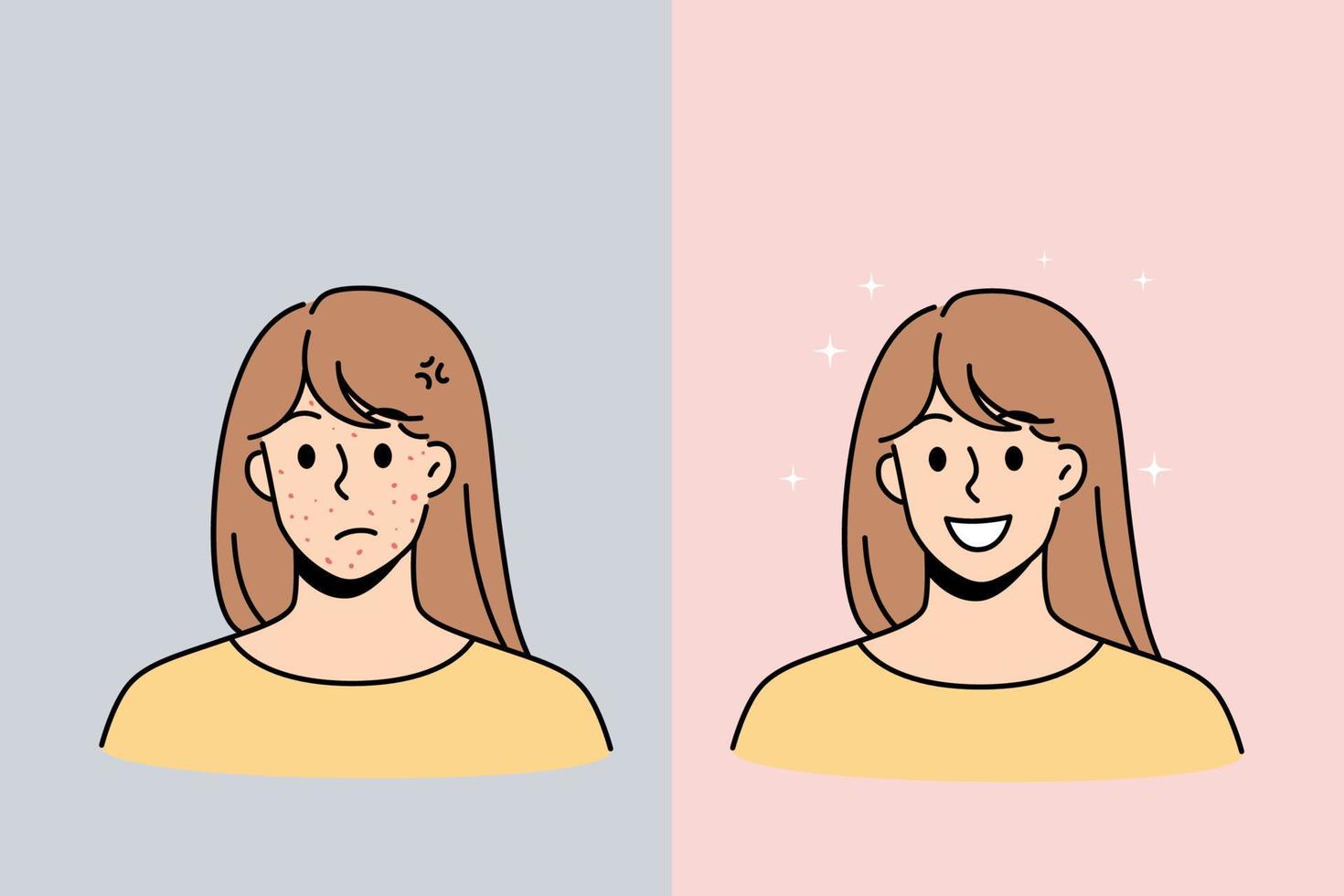 Skin problem and health concept. Stressed unhappy young woman with red acne pimples and smiling with healthy skin face vector illustration