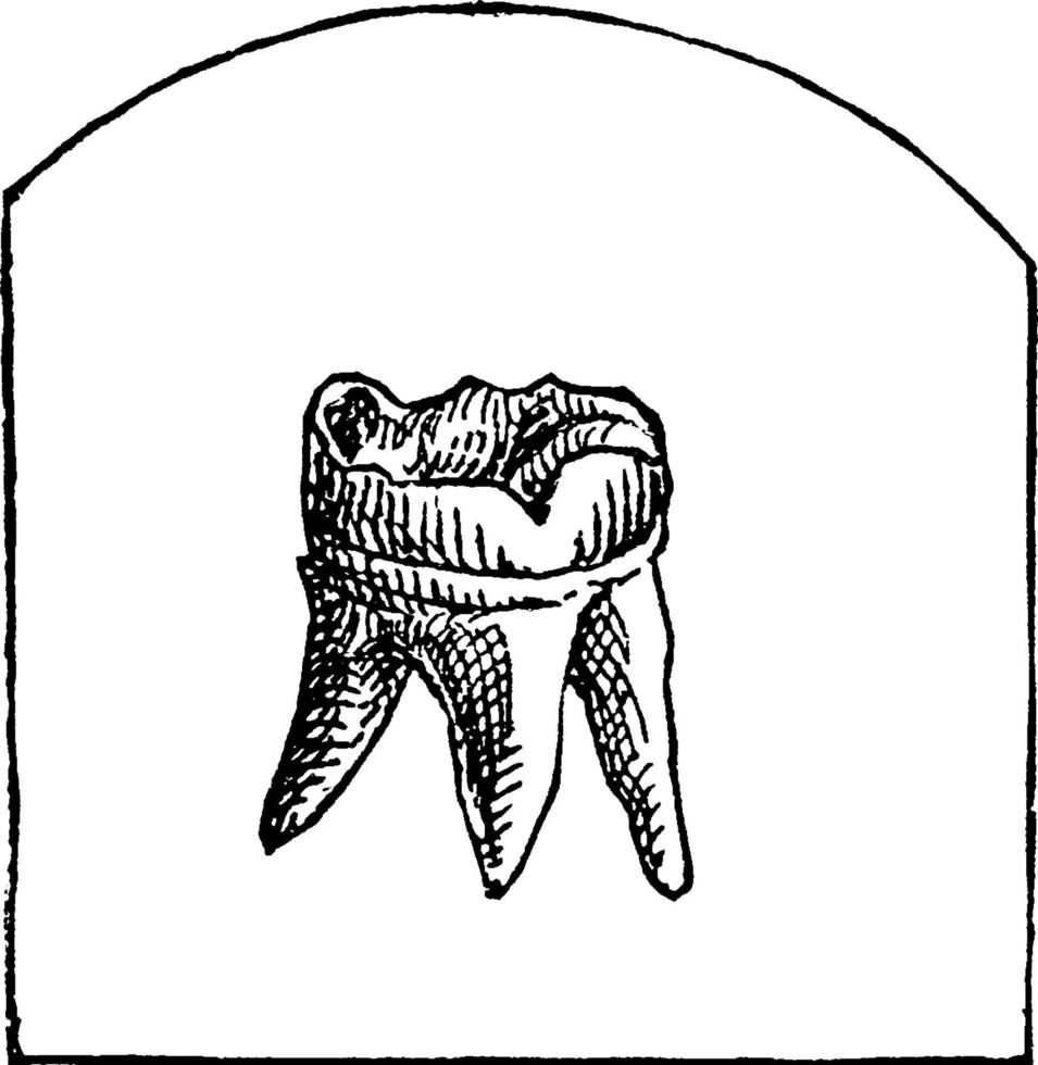 Tooth, vintage illustration. vector