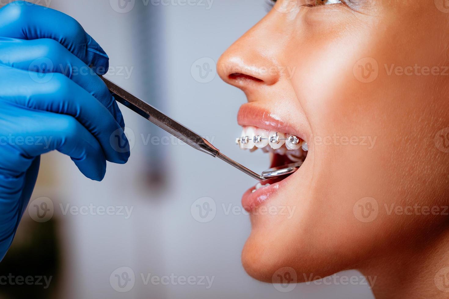 mujer sonriente en el dentista foto