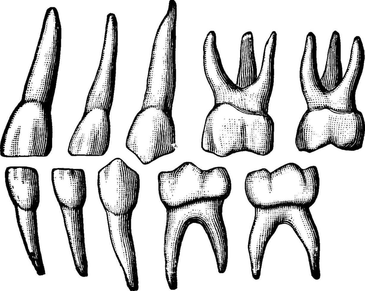 Temporary Teeth, vintage illustration. vector