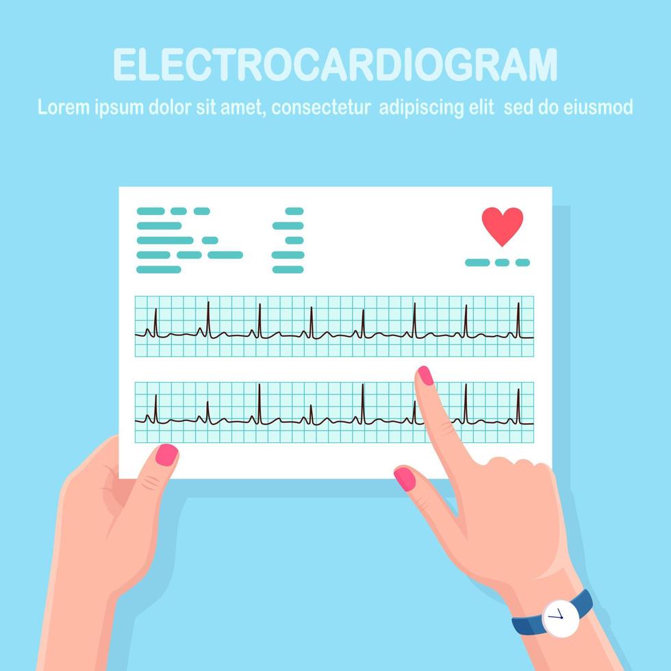 Cardiogram in doctor hand. Diagnosis cardiovascular disease. Chart of heart beat rhythm. Ecg document vector