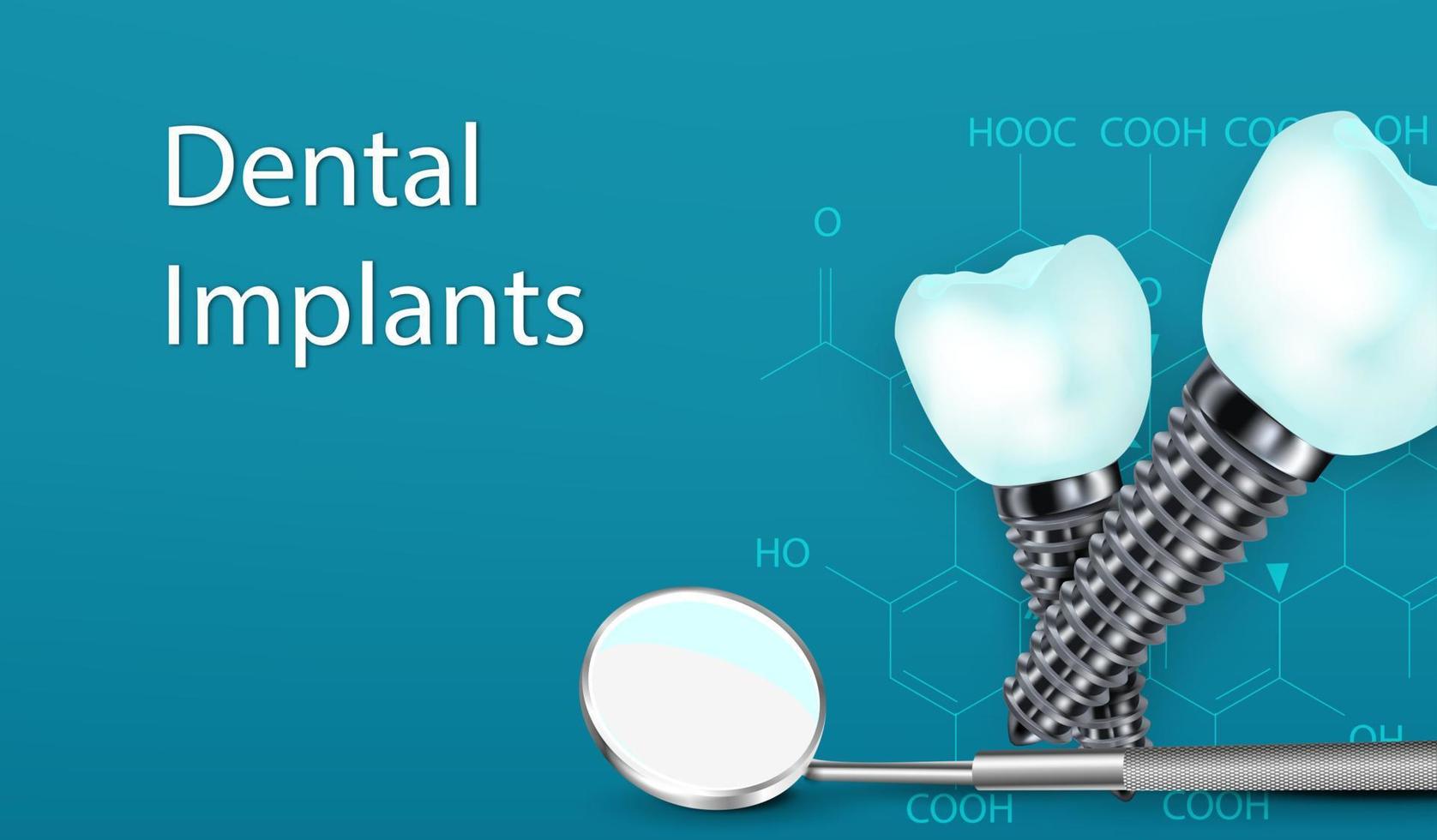 Concepto de cirugía de implantes dentales 3d con herramienta. vector