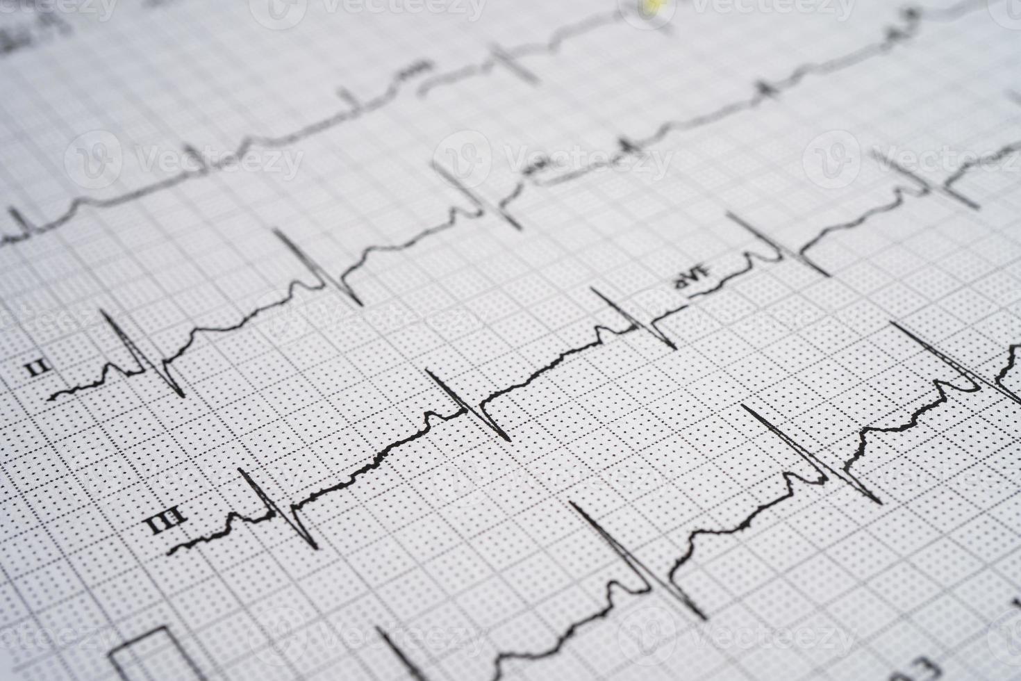 electrocardiograma ecg con corazón rojo, onda cardíaca, ataque cardíaco, informe de cardiograma. foto