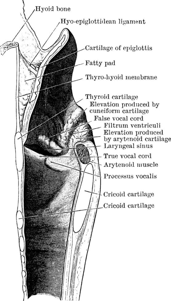 Mesial section through larynx, showing the outer wall of the right half, vintage illustration. vector
