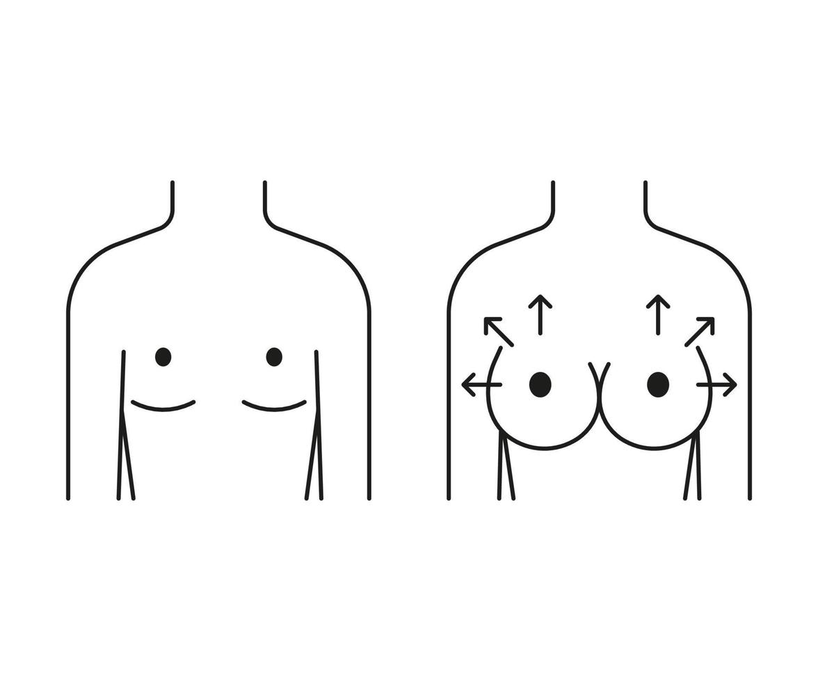 Woman breast lift, increase in size and reshape, line icon. Different shape and size. Breast augmentation. Small and full breast front view. Vector outline illustration