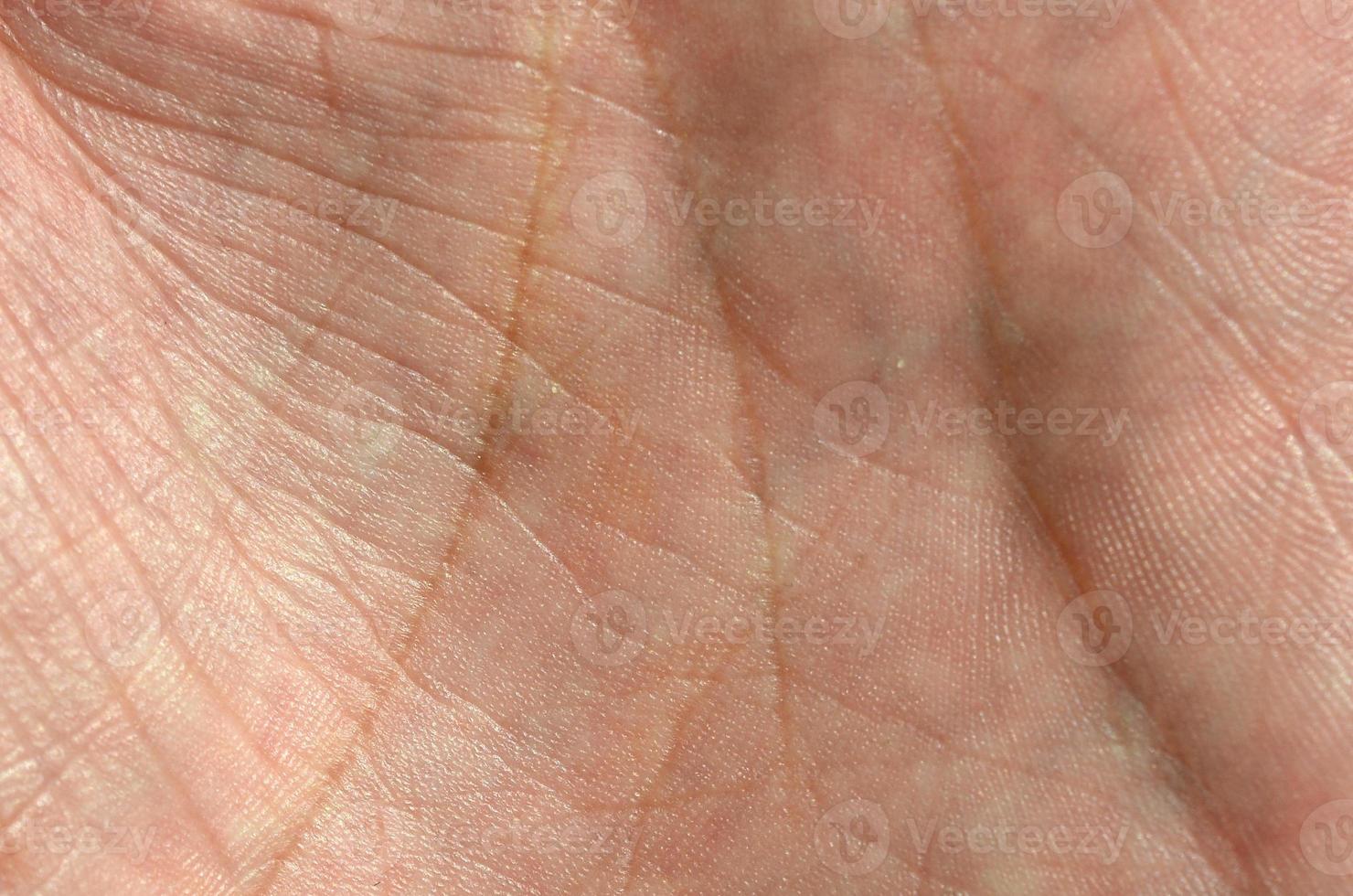 Close up of human hand skin with visible skin texture and lines photo