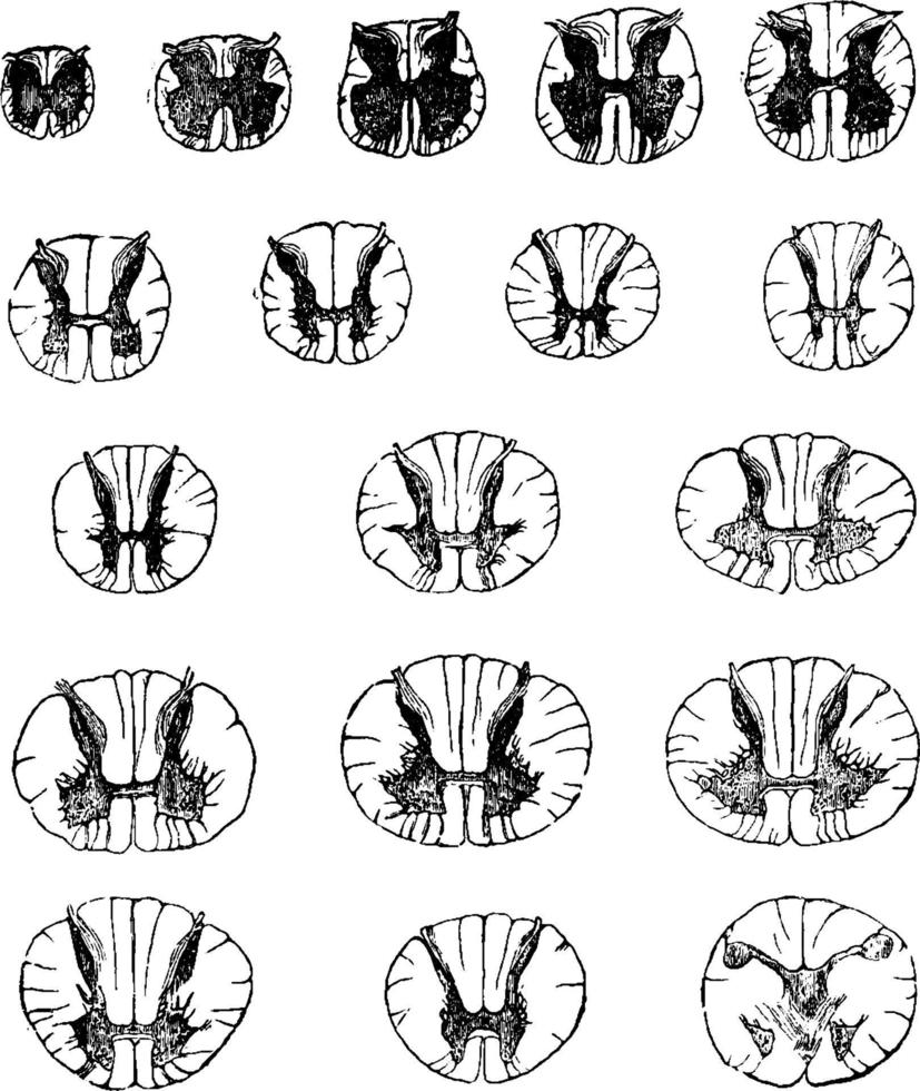 Transverse Sections of Spinal Cord, vintage illustration. vector