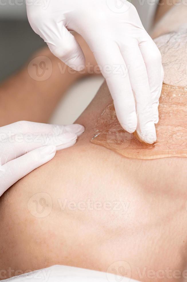 Epilation chest of young male photo