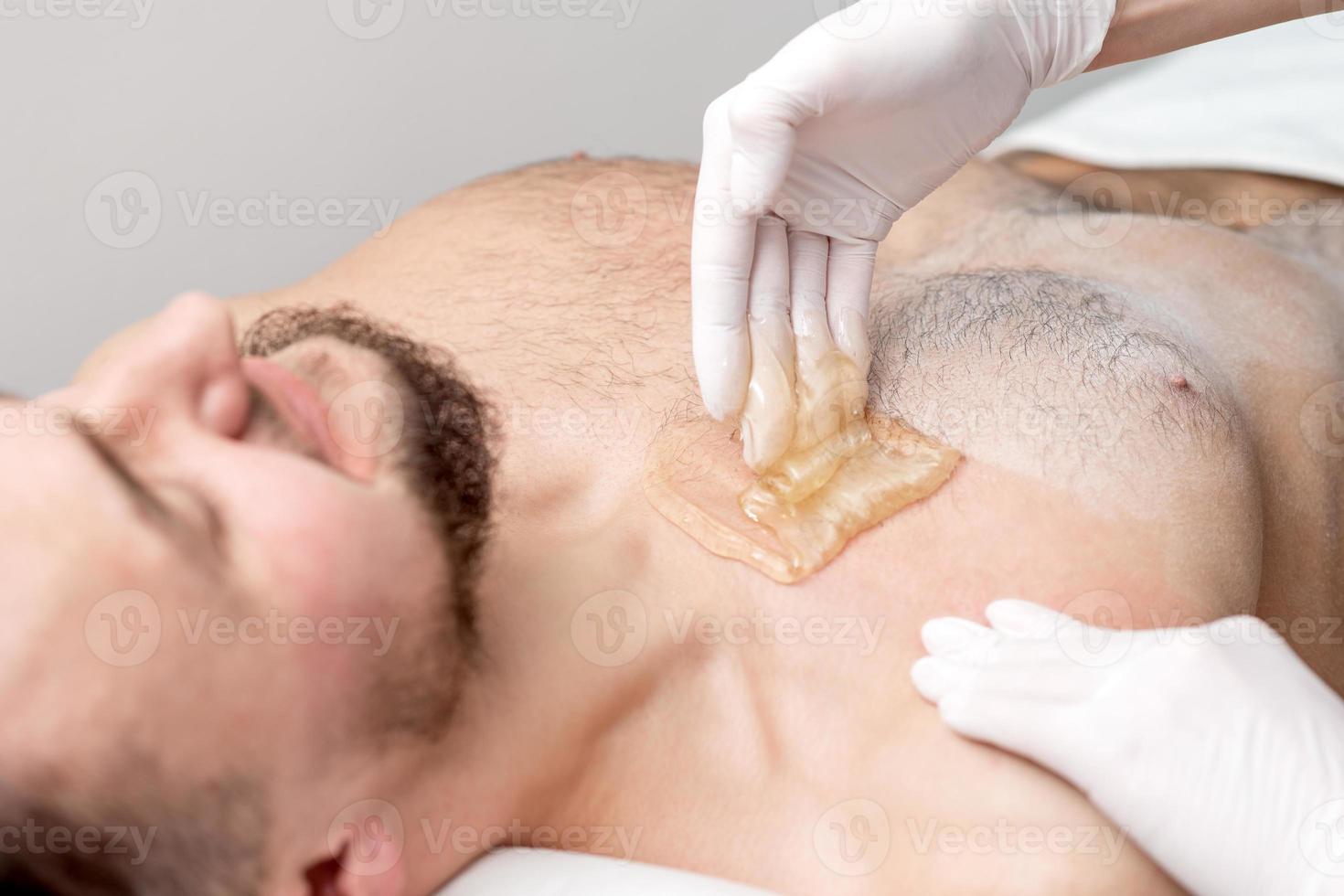 Epilation chest of young male photo