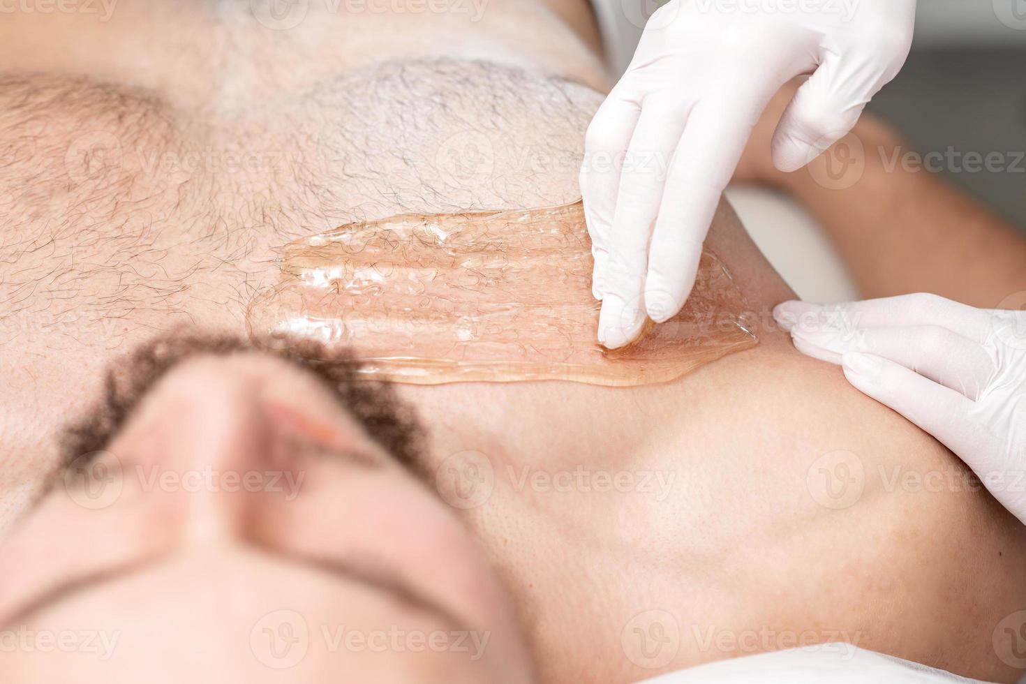 Epilation chest of young male photo