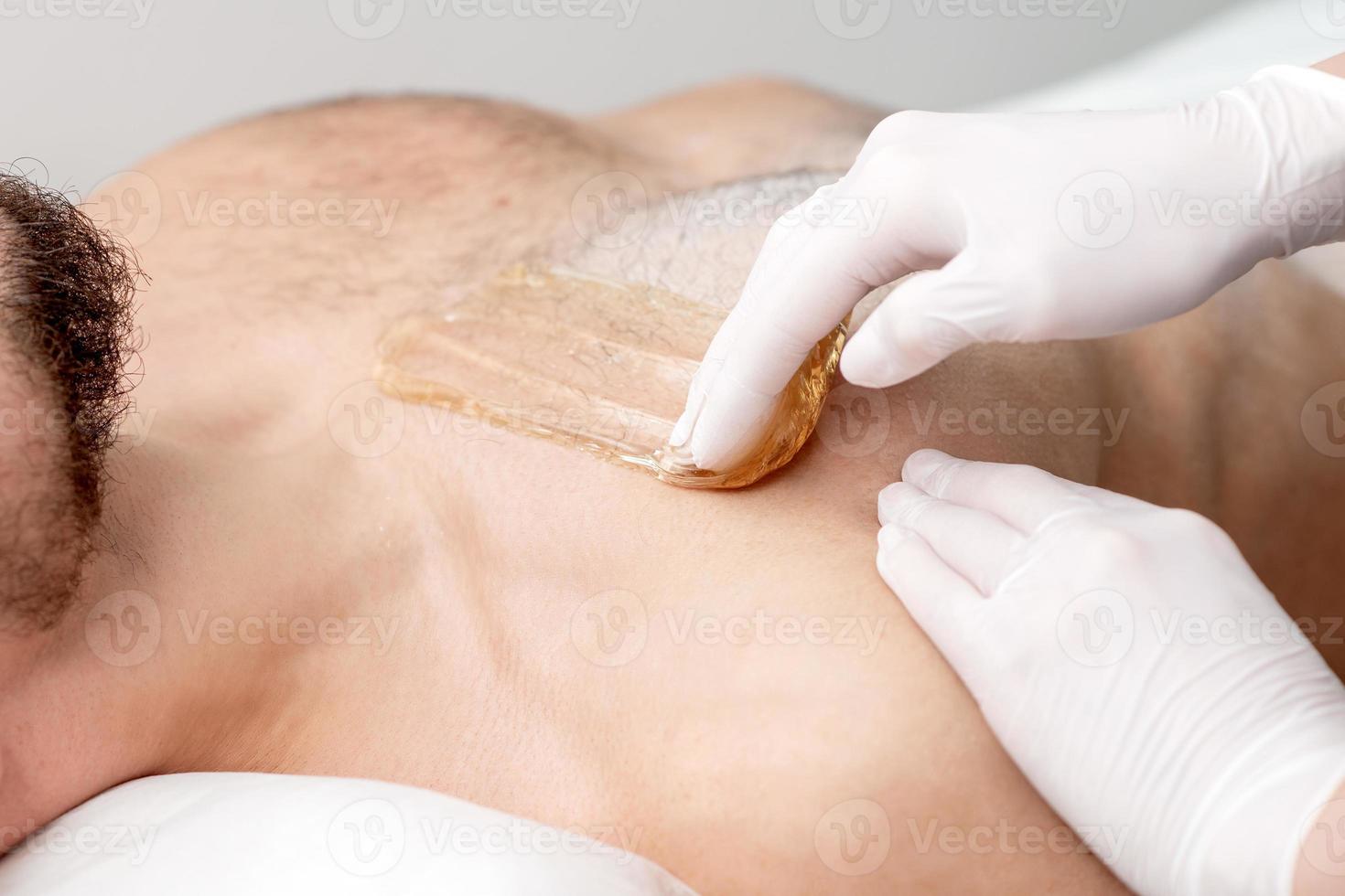 Epilation chest of young male photo