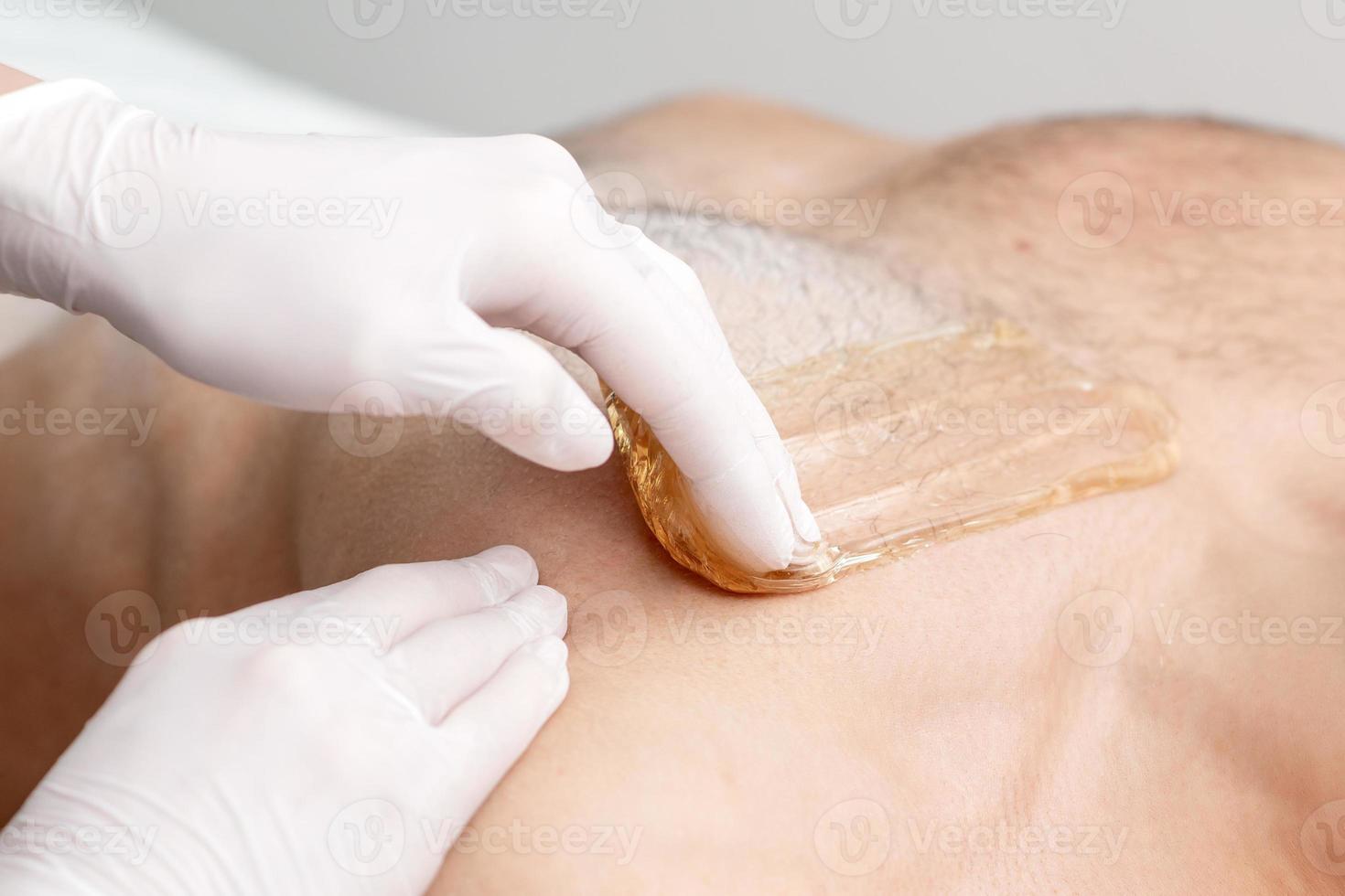 Epilation chest of young male photo