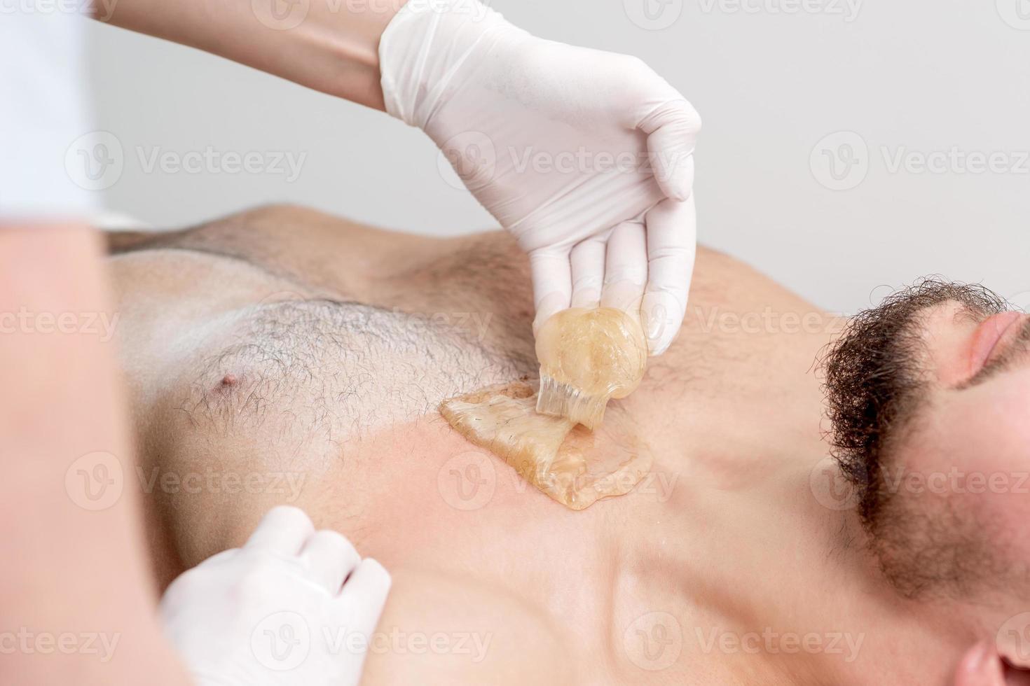 Epilation chest of young male photo