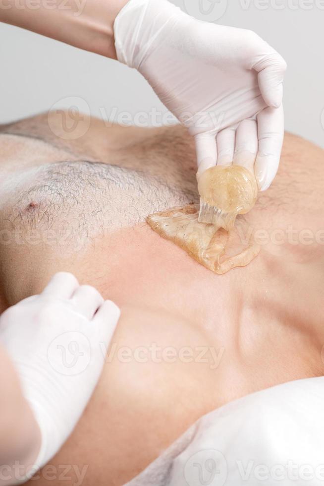 Epilation chest of young male photo