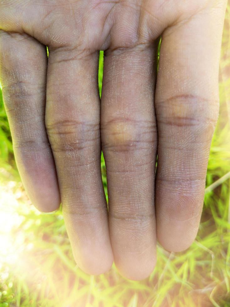 the fingers of a farmer with dry skin photo