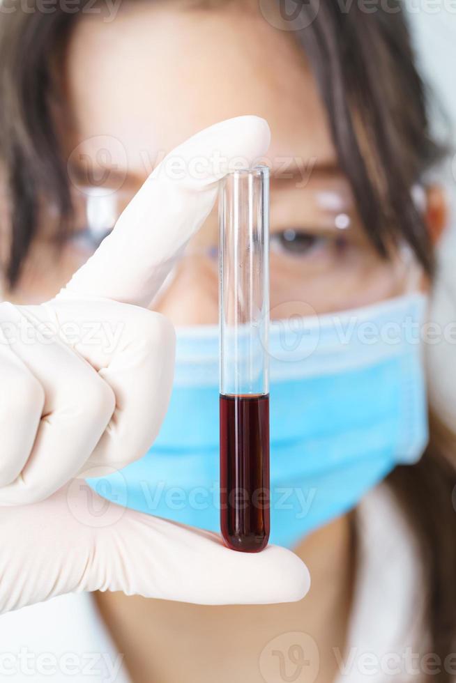 Scientist analyzing holding blood sample in test tube photo