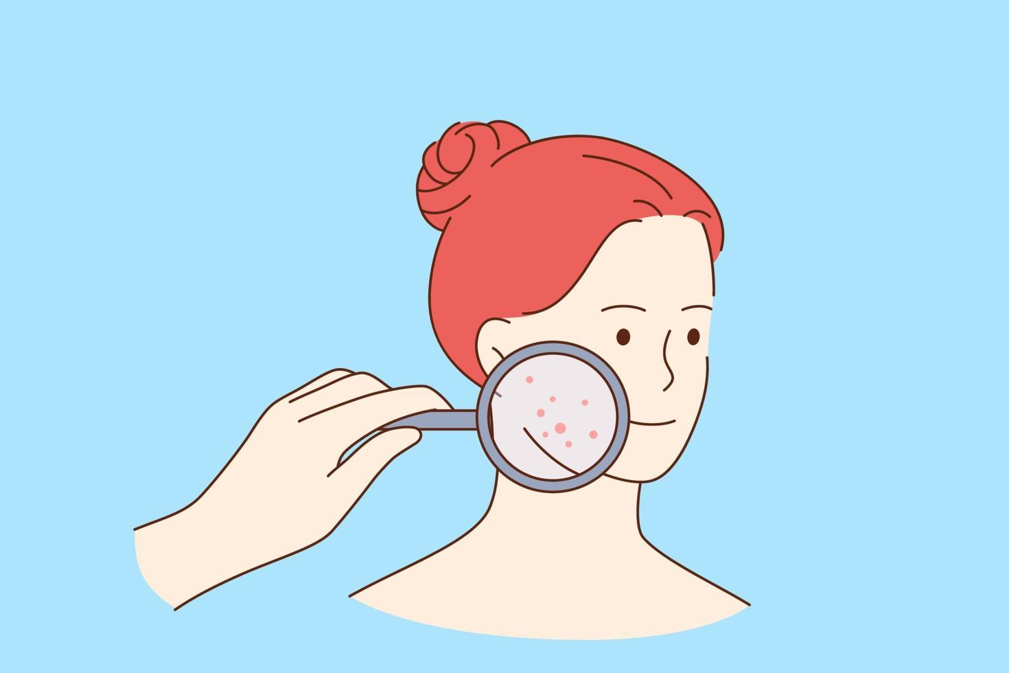 Skin problems and beauty concept. Face of young smiling pretty red haired woman cartoon character with magnifying glass and red pimples on skin vector illustration