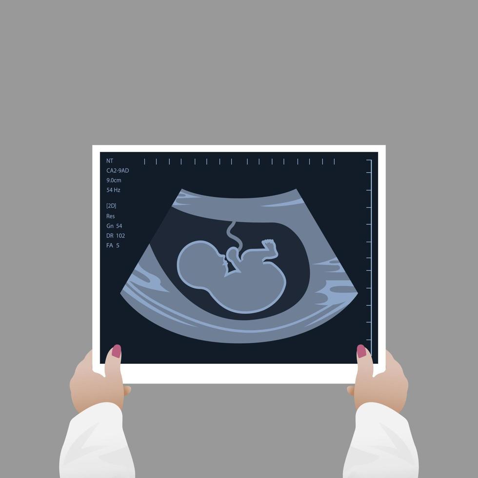 A female doctor looks at the result of an ultrasound scan. Medical diagnosis of a child in the womb, pregnancy and health vector