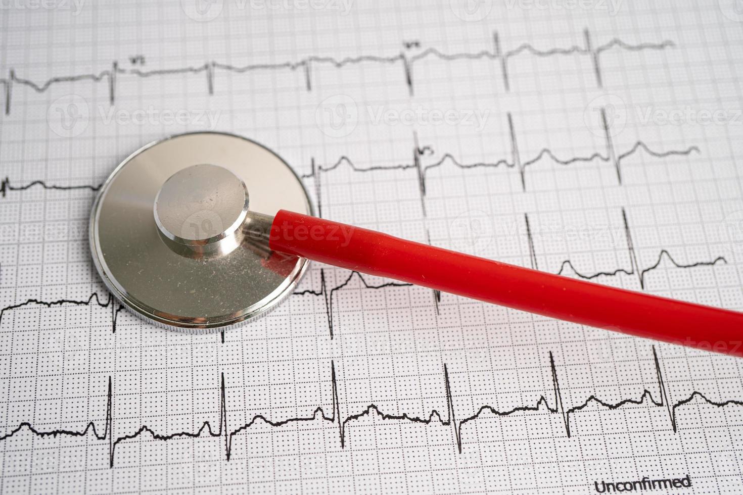 estetoscopio en electrocardiograma ecg con corazón rojo, onda cardíaca, ataque cardíaco, informe de cardiograma. foto