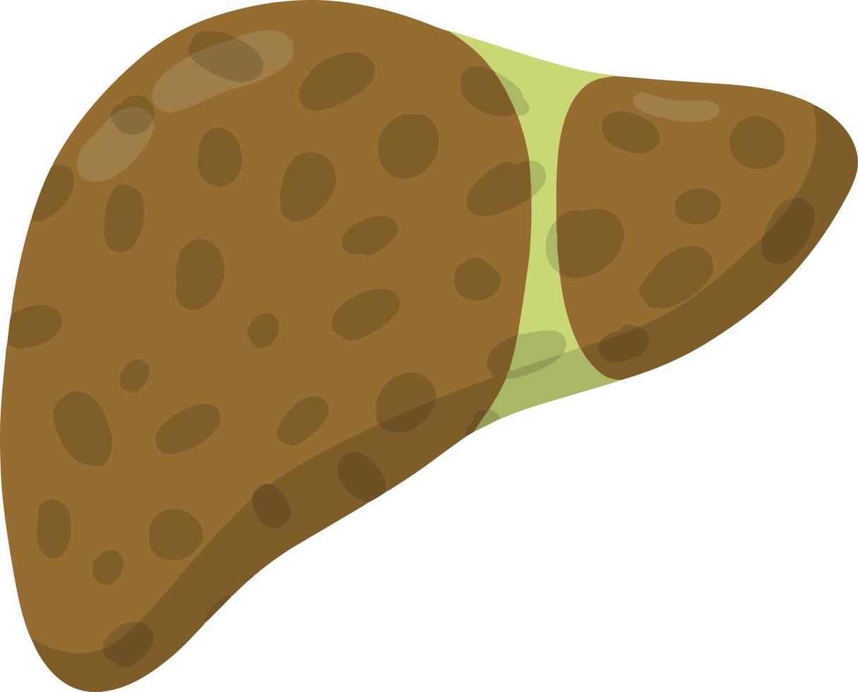 Bad liver. Medical Disease of human internal organ. Cartoon flat illustration. Health problem - Cirrhosis vector