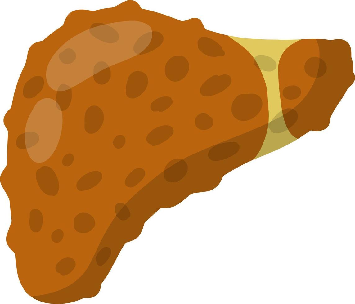 Bad liver. Medical Disease of human internal organ. Cartoon flat illustration. Health problem - Cirrhosis vector