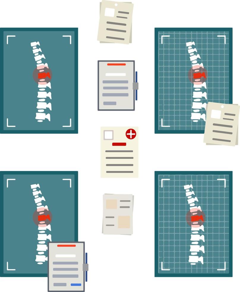 Spine on x-ray image. The bones of the back. Set of Medical document. A red dot of pain. Spinal column injury. Poor posture. Health care. White vertebra. Caroon flat illustration vector