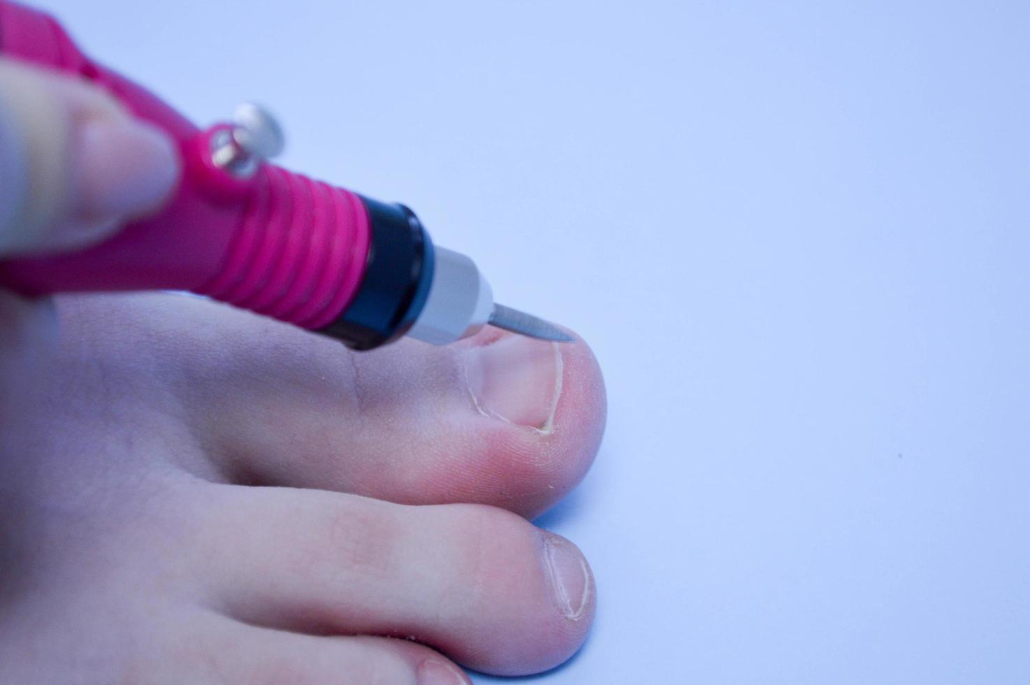 The process of doing a pedicure on the toes of the nail processing of the nail with the help of a special machine on a blue background photo