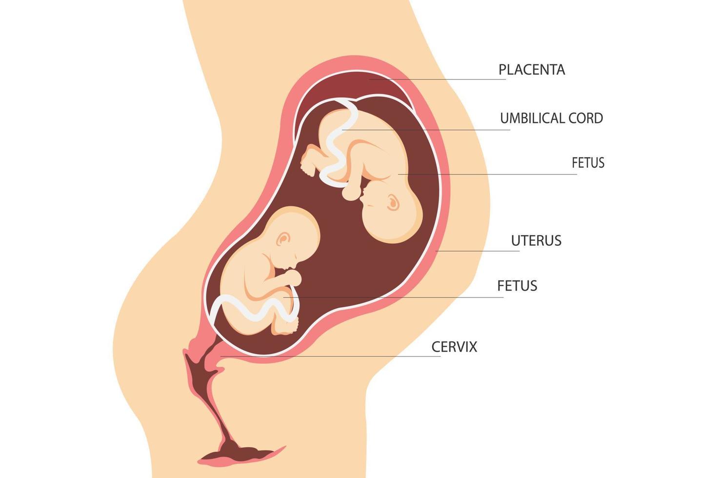 Double pregnancy. Anatomy of the uterus with twin fetuses. Placement of dizygotic twins. flat illustration vector